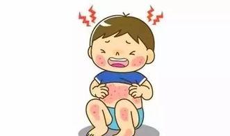 湿疹患者吃葫芦瓜,天然食疗的神奇疗效