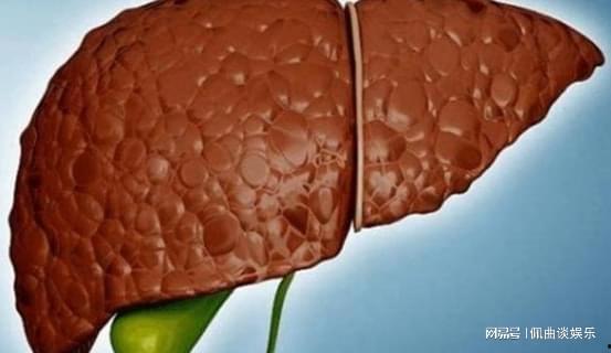 肝硬化可以吃瓜吗,瓜类食物的适宜摄入与禁忌